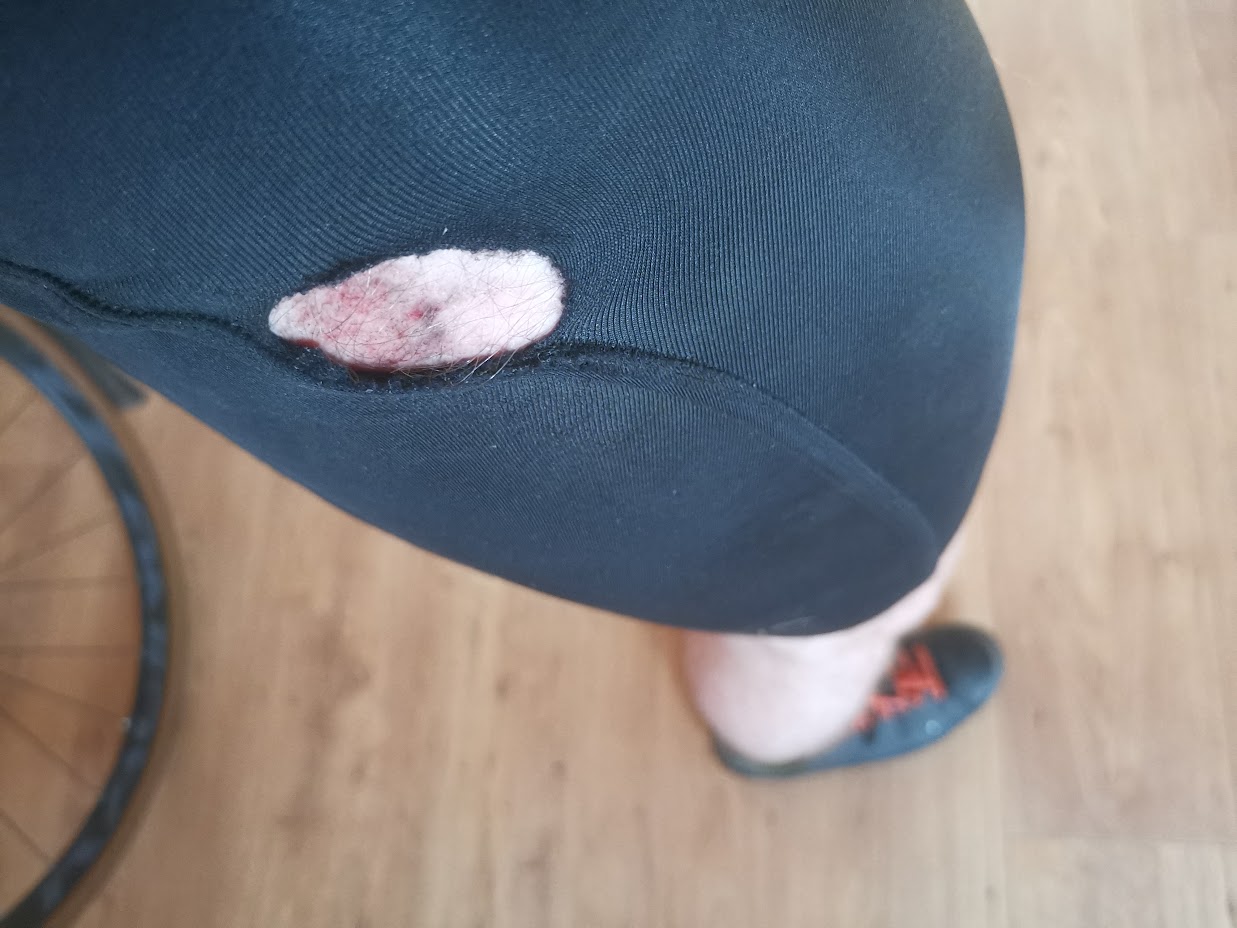 Ripped shorts after an encounter with a badly designed entrance kerb